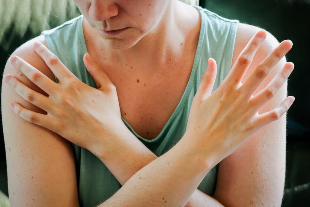 Person demonstrating EMDR tapping points on knees